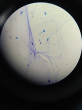 an image under a microscope, a cream circle with blue dots and soft lines